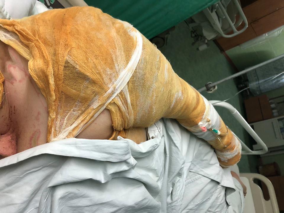 За словами Гандзюк, за напад на неї заплатили 500 доларів, і вона була готова заплатити більше, щоб не чіпали