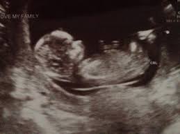 Знімки УЗД на 23 тижні вагітності: