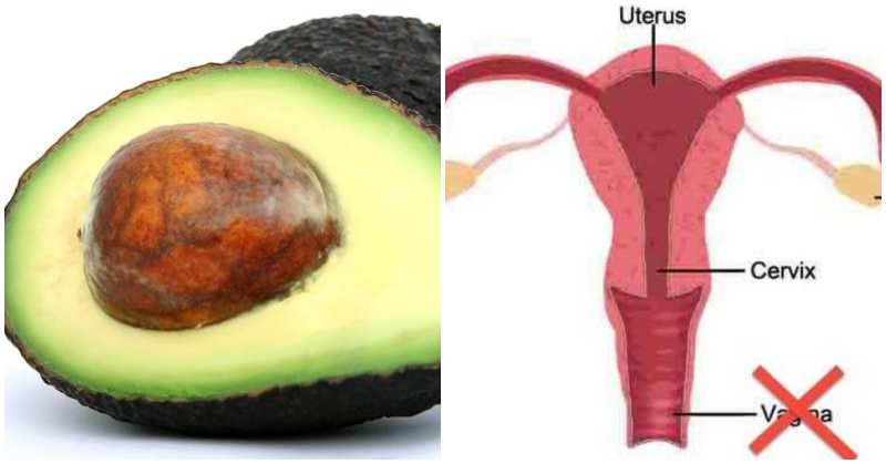 Вчені помітили цікавий факт подібності жіночої матки з фруктом авокадо